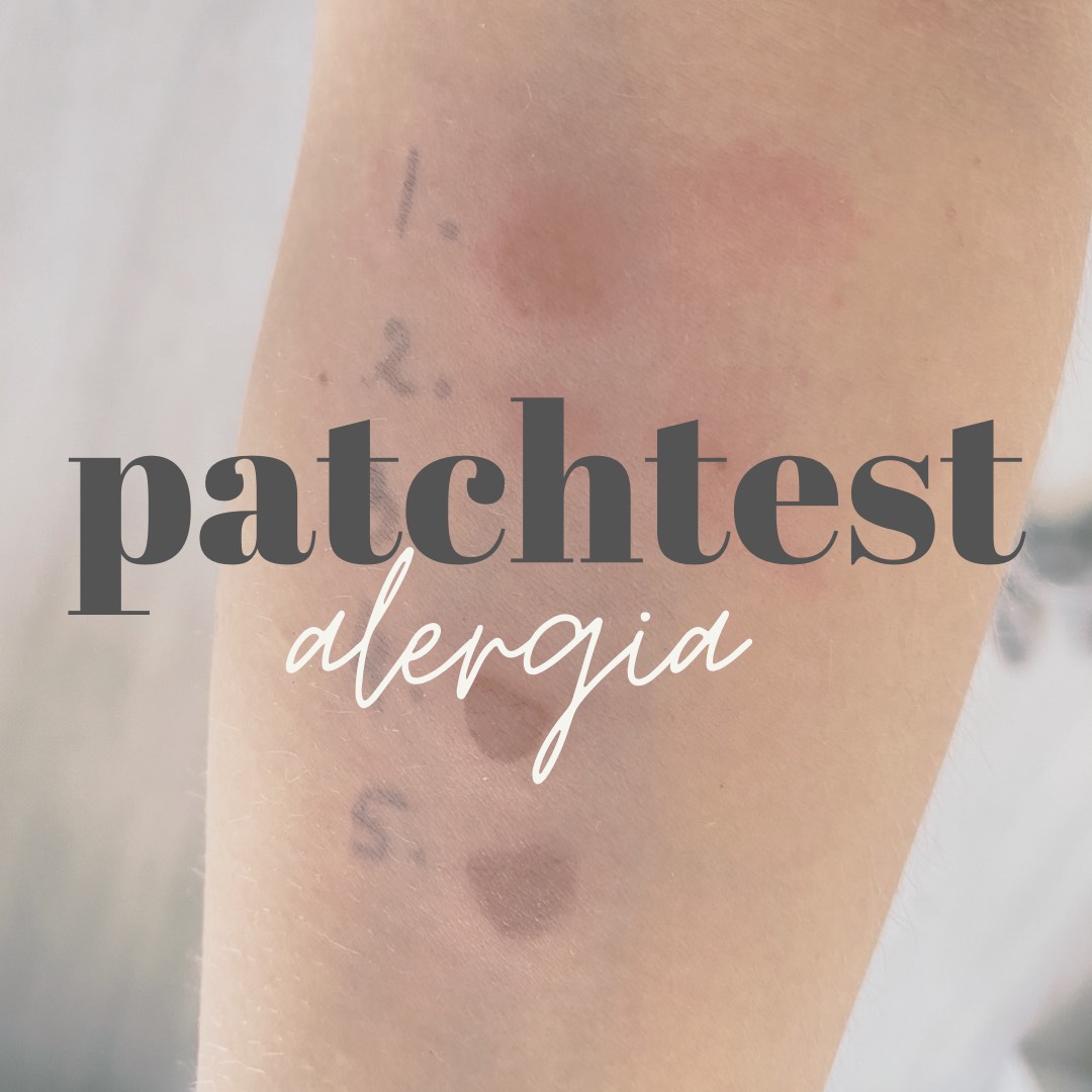 patchtest-reka-alergeny